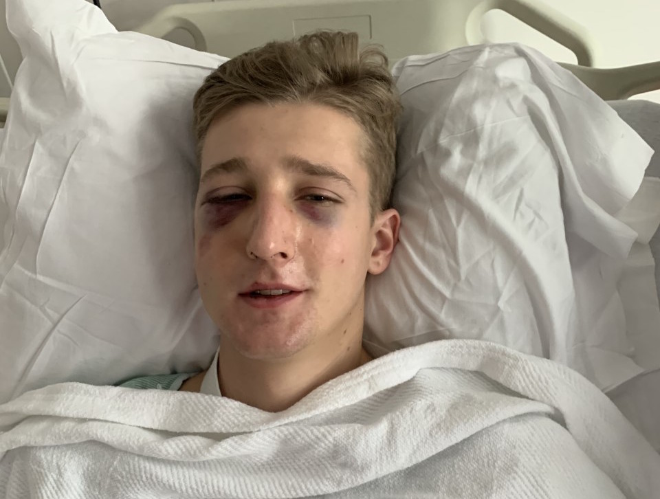 Battered, bruised - but itching to return: Jack Gilligan recovering in hospital after his horrible fall