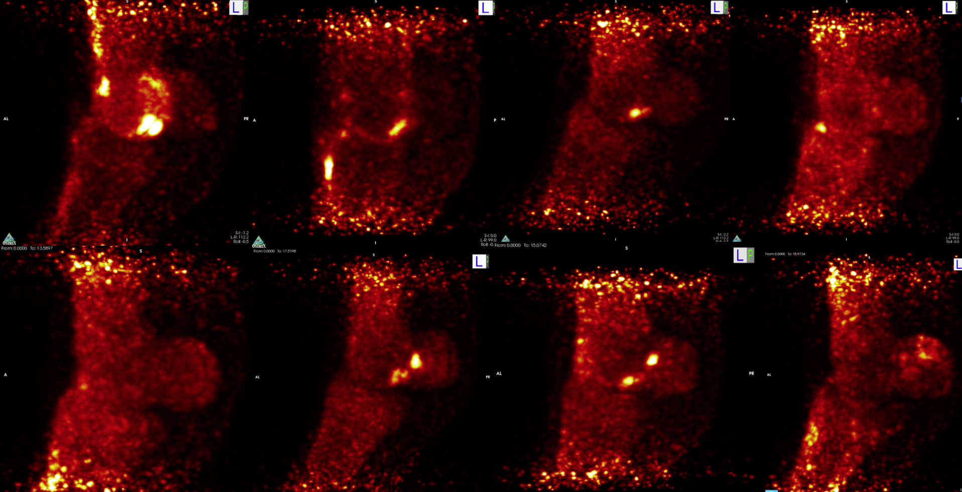 Significant variations: Scans of different horses’ fetlocks show clear differences